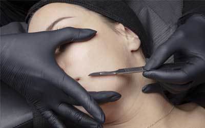 Dermaplaning Las Vegas Henderson NV